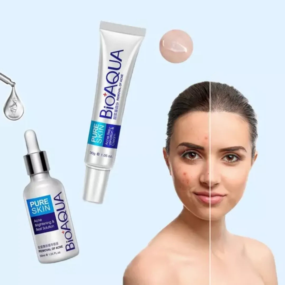 Kit Antiacné Bioaqua – Controla Brotes, Aclara Manchas y Renueva tu Piel