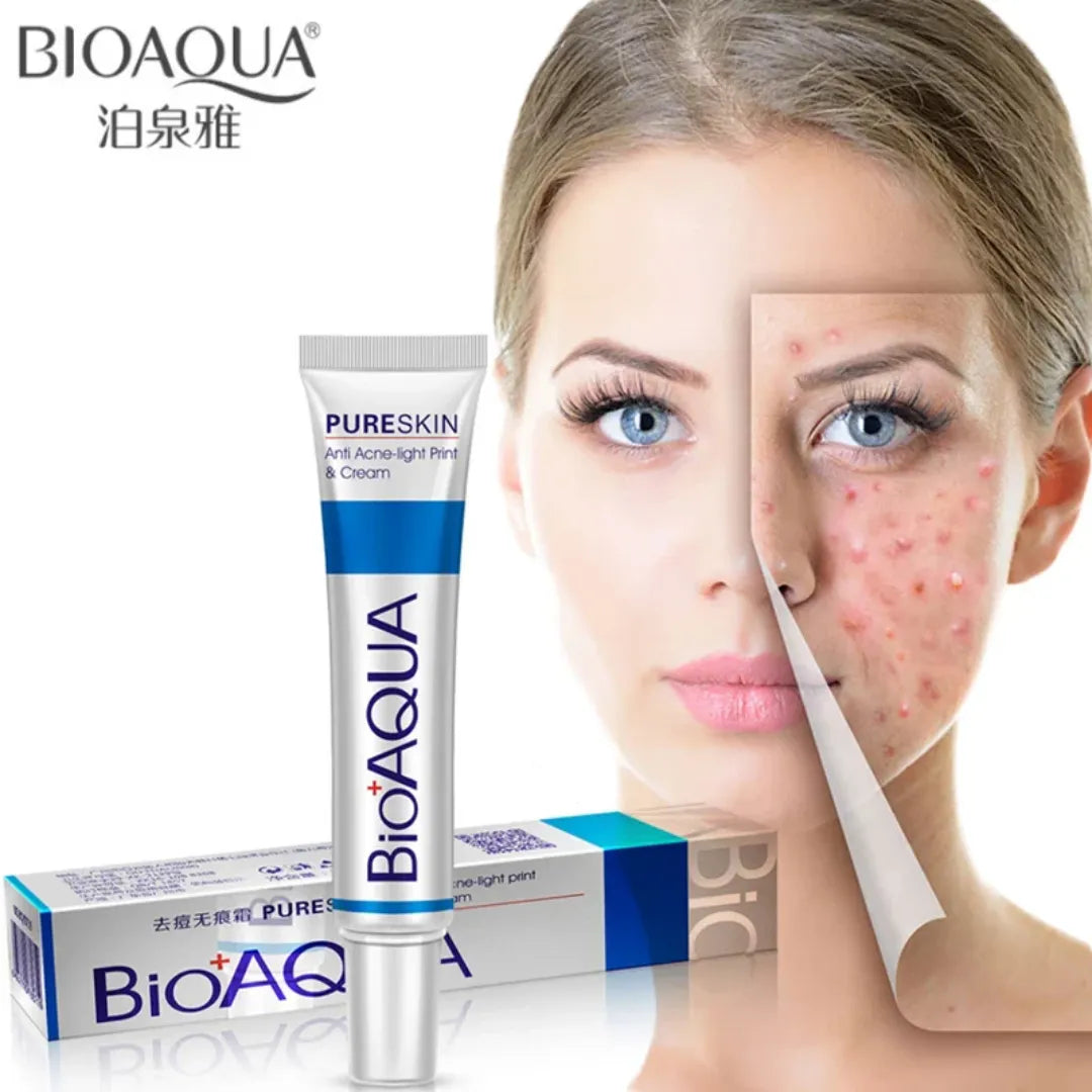 Kit Antiacné Bioaqua – Controla Brotes, Aclara Manchas y Renueva tu Piel